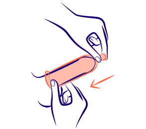 Préservatif externe déroulé sur un pénis en érection